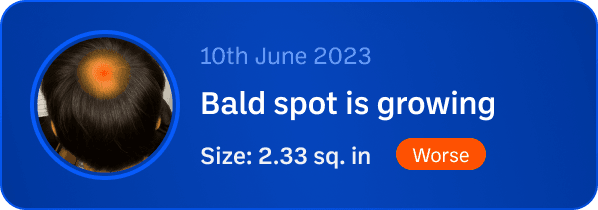 Bald spot middle