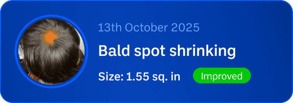 Bald spot top