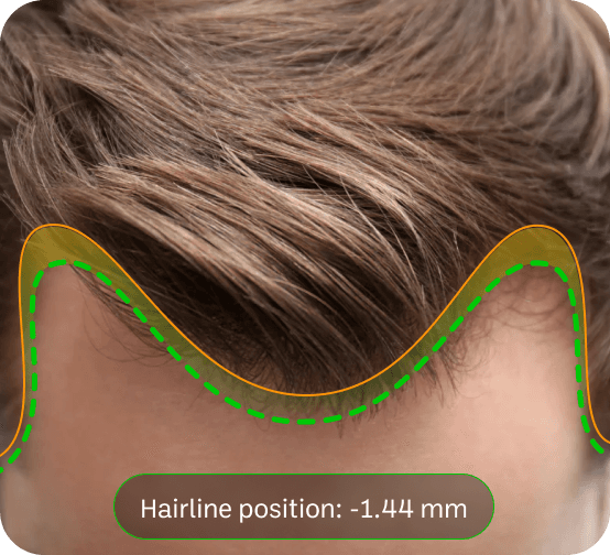 Hairline promo
