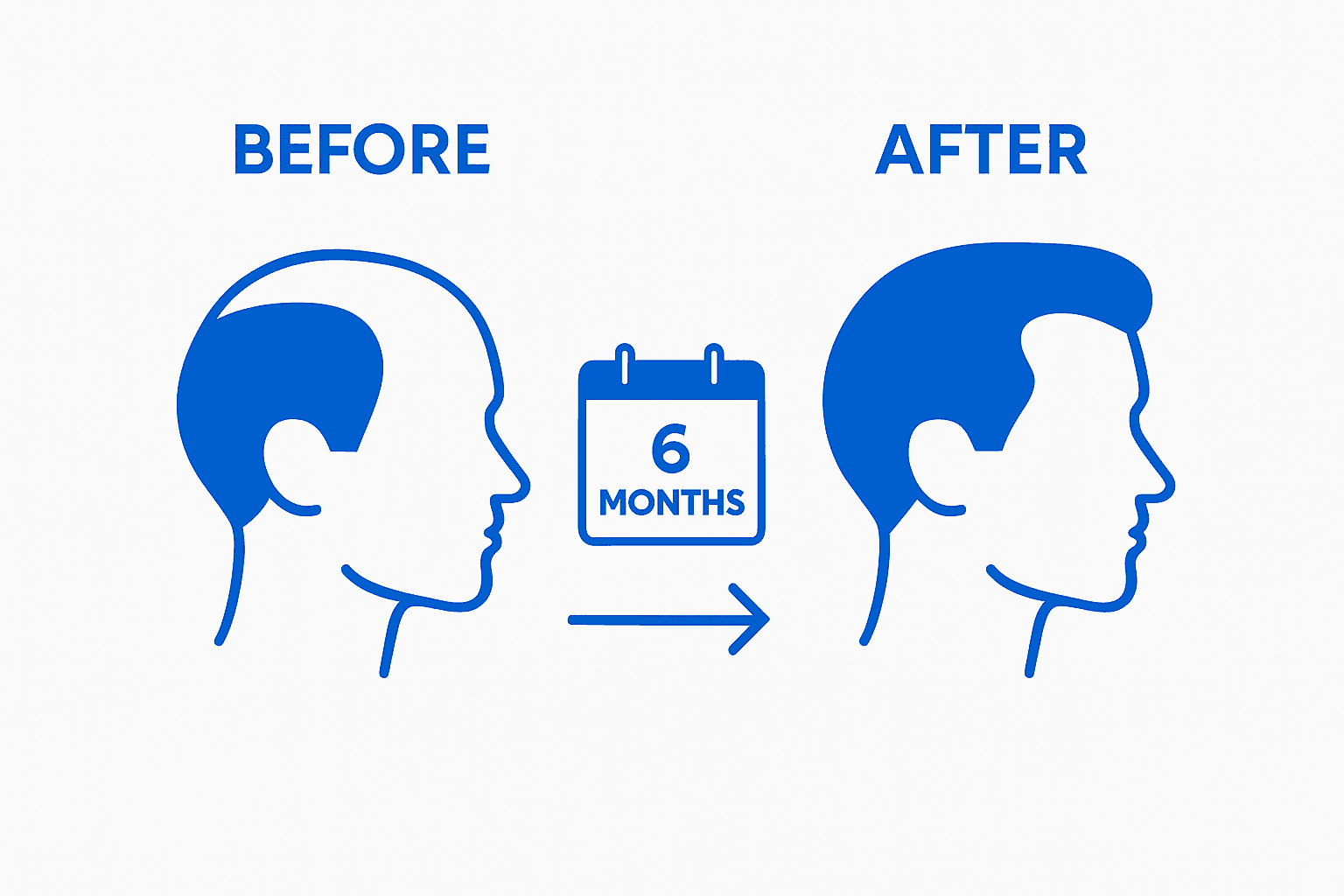 Simple before/after rogaine hairline results