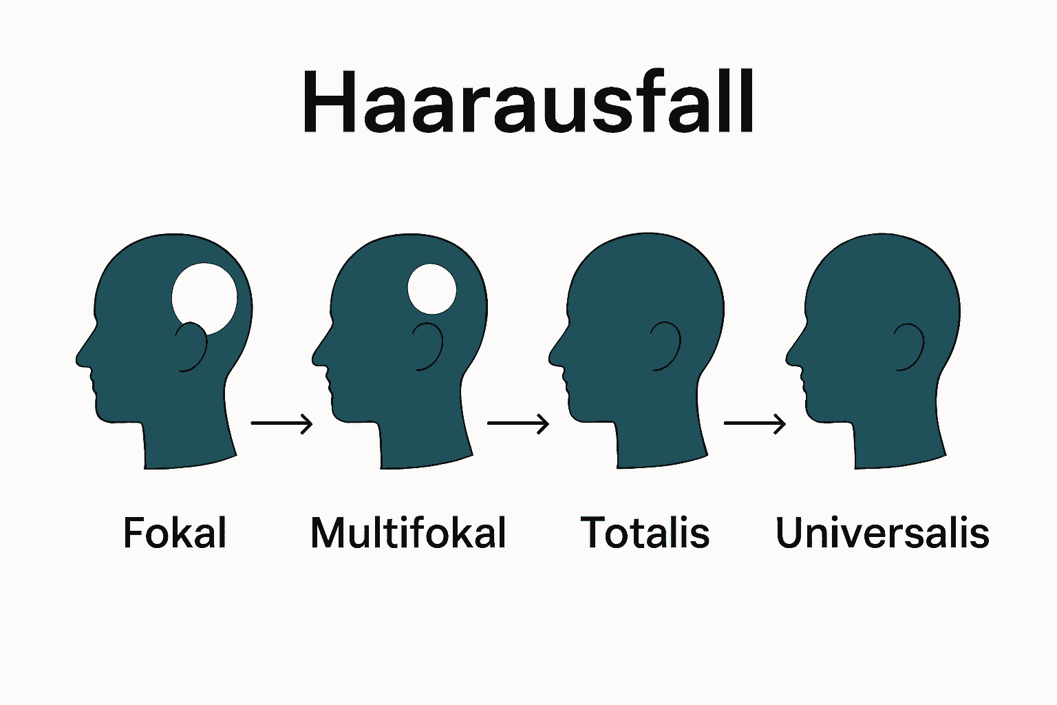 Vergleich der Arten von kreisrundem Haarausfall.