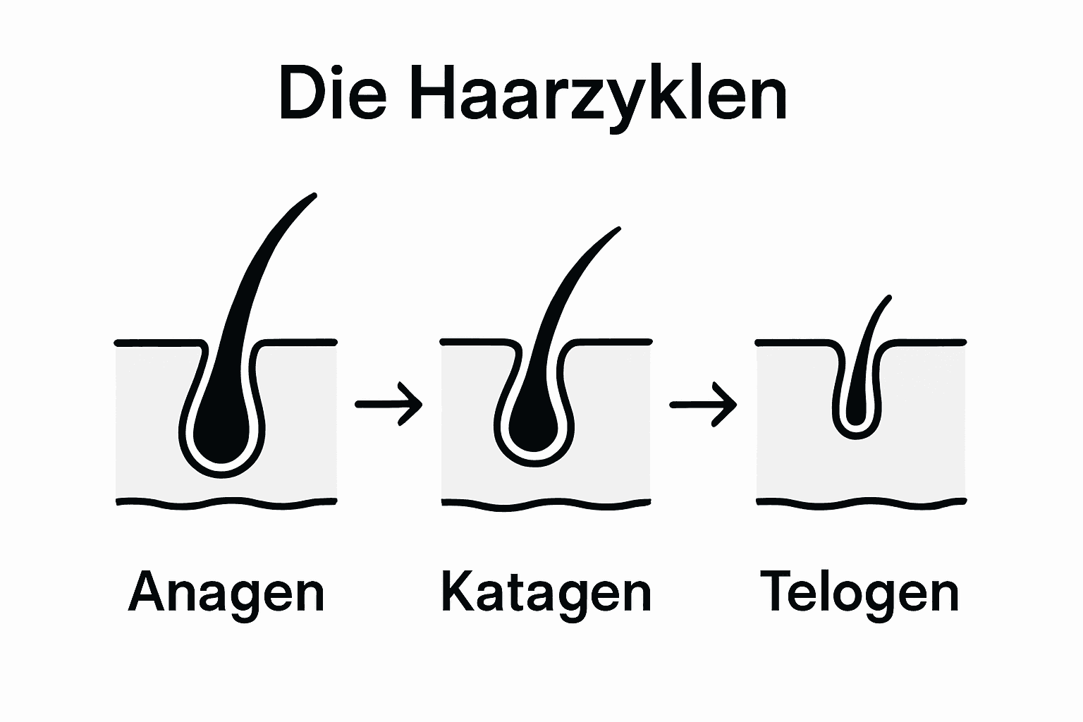 Grafische Übersicht der verschiedenen Phasen des Haarwachstums