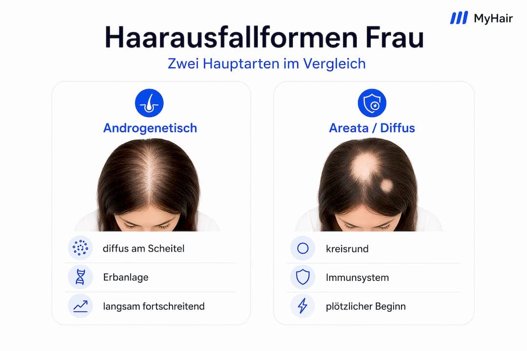 Übersicht: Die häufigsten Formen des Haarausfalls bei Frauen