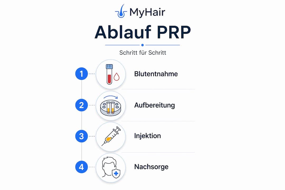 So läuft eine PRP-Haarbehandlung ab – Schritt für Schritt anschaulich erklärt