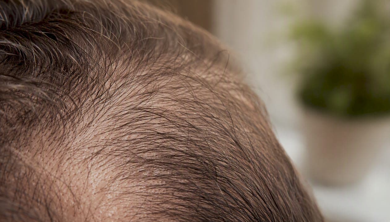 Detailaufnahme der Kopfhaut mit kräftigen, gesunden Haarwurzeln
