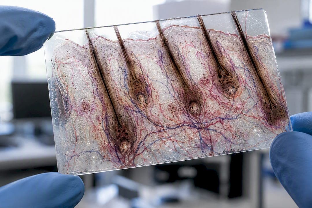 Makroaufnahme eines Haarfollikels auf der Kopfhaut mit Nerven und Gefäßen
