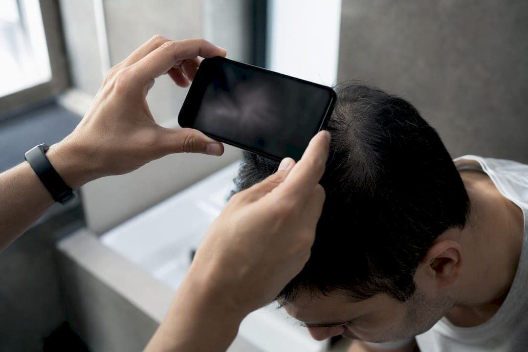 Manos tomando fotos del cuero cabelludo con un smartphone
