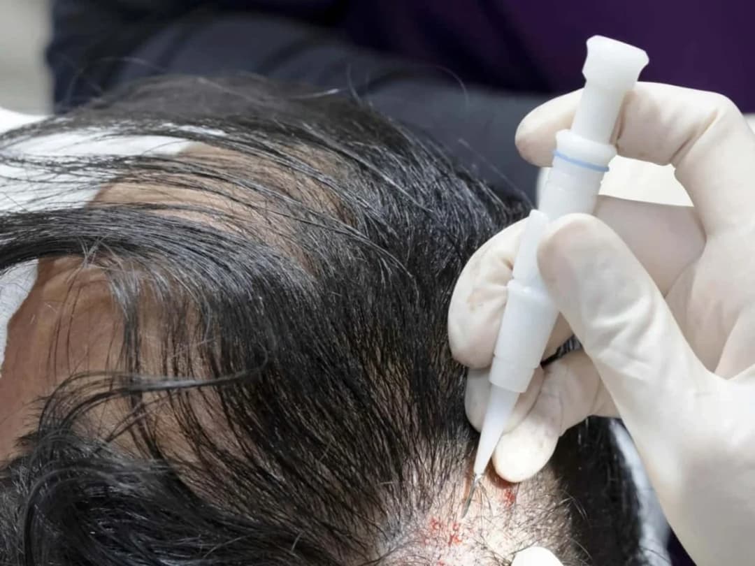 Advanced Hair Clinics clinic 1