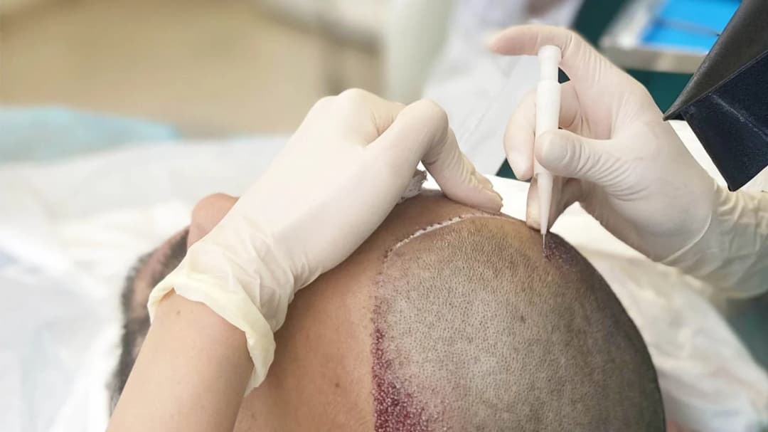 Advanced Hair Clinics clinic 4